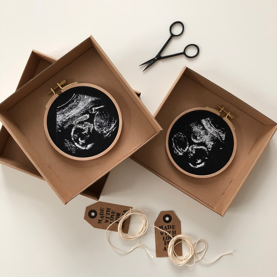 Embroidered sonogram imagery in a hoop. Embroidered sonogram imagery in a hoop.