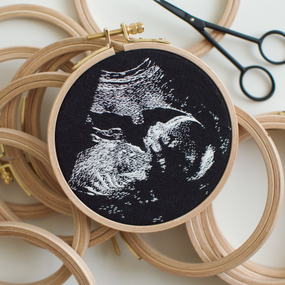 Embroidered sonogram imagery in a hoop. Embroidered sonogram imagery in a hoop.