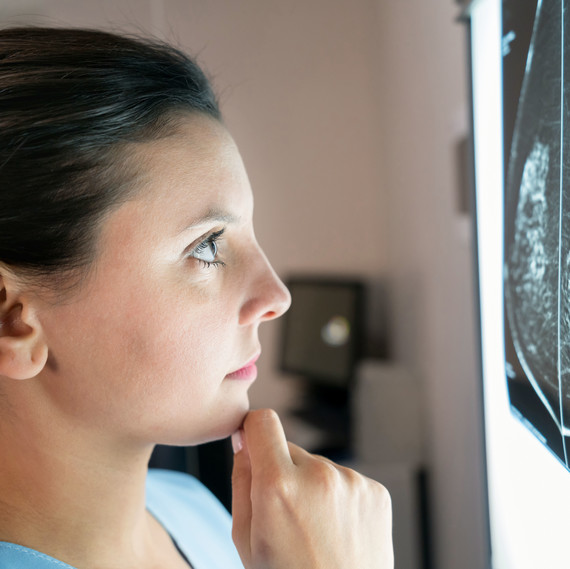 woman looking at x-ray results woman looking at x-ray results
